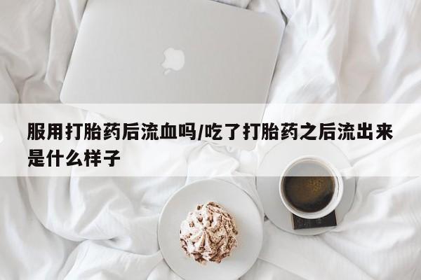 流产药购买方式服用打胎药后流血吗/吃了打胎药之后流出来是什么样子